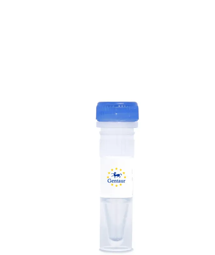 Anti-Vibrio cholerae ctxB/Cholera Toxin Subunit B Antibody